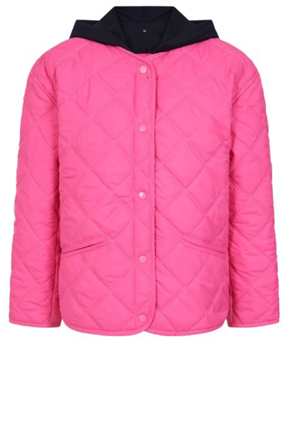 Fuchsia Removable Hood Quilted Alena Jacket